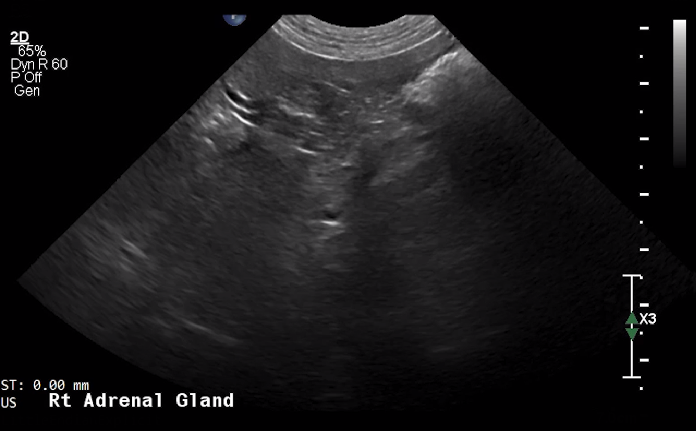 Canine Right Adrenal Gland (Transverse) – NORMAL