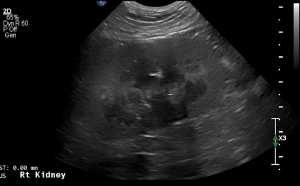 Canine Right Kidney (Longitudinal) 1 - NORMAL