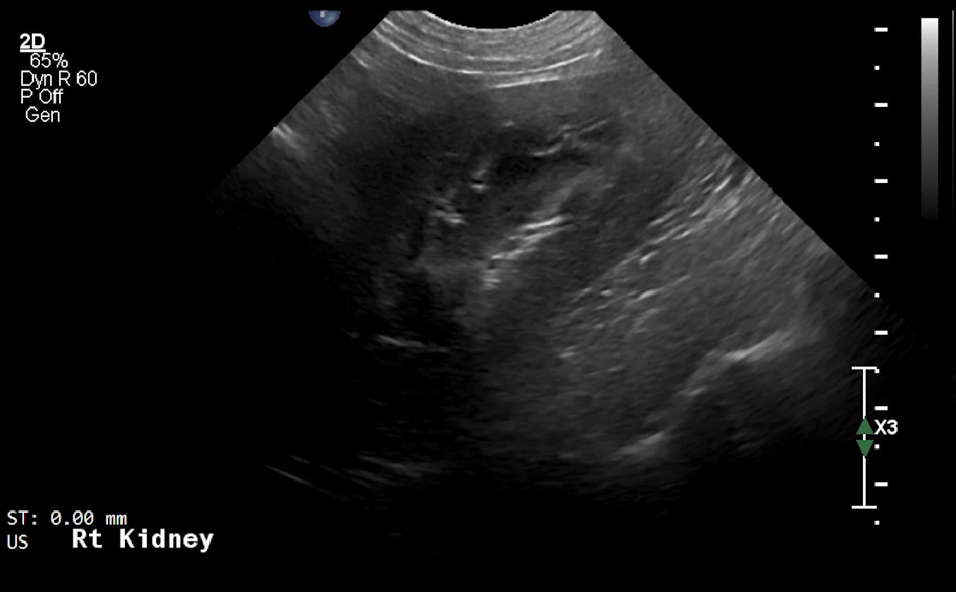 Canine Right Kidney (Longitudinal) 2 – NORMAL