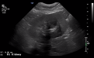 Canine Right Kidney (Transverse) - NORMAL