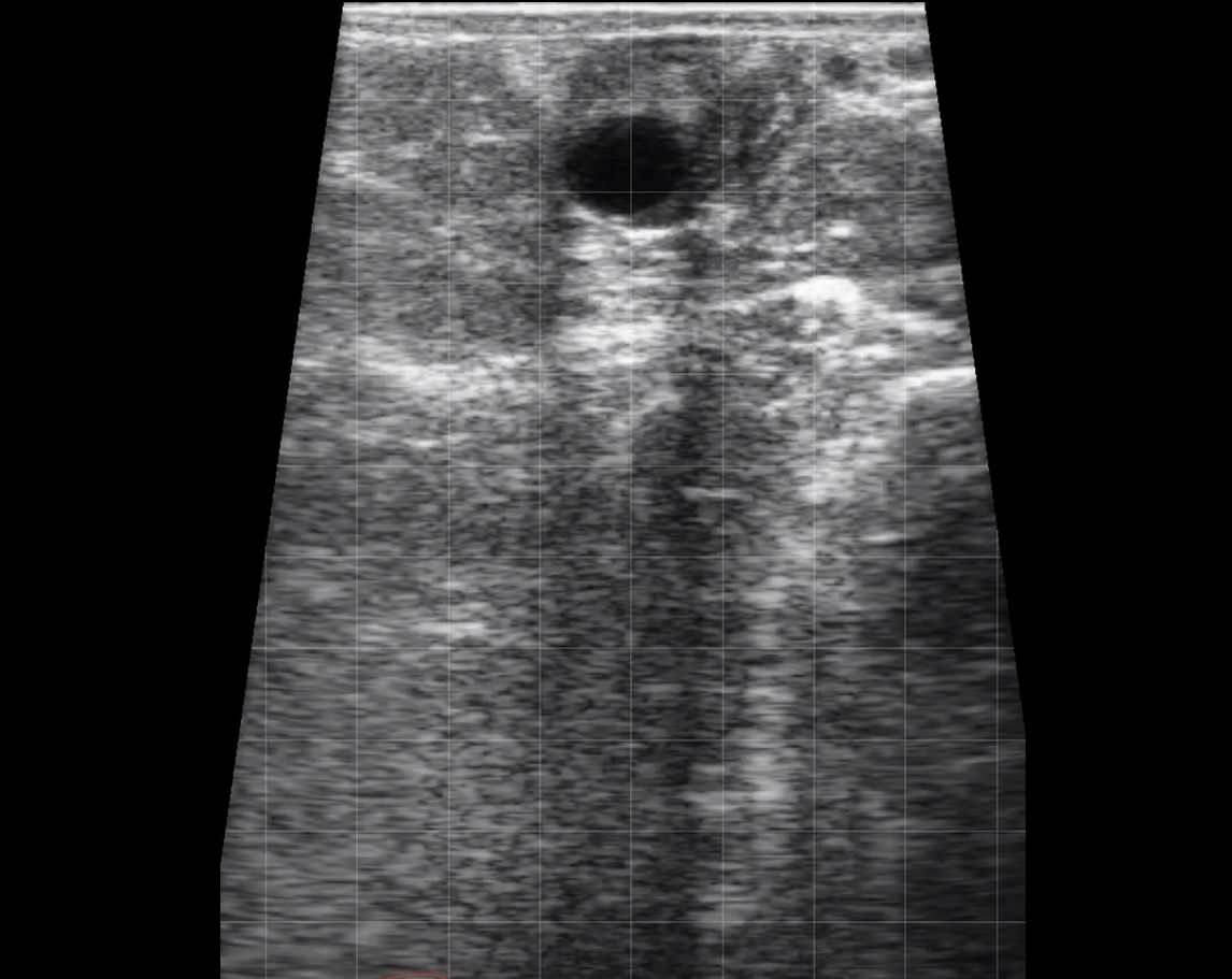 Bovine Right Uterine Horn (Normal)