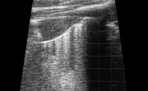 Calf Severe Lung Consolidation 11