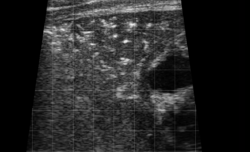 Calf Severe Lung Consolidation 3