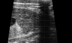 Calf Severe Lung Consolidation 6