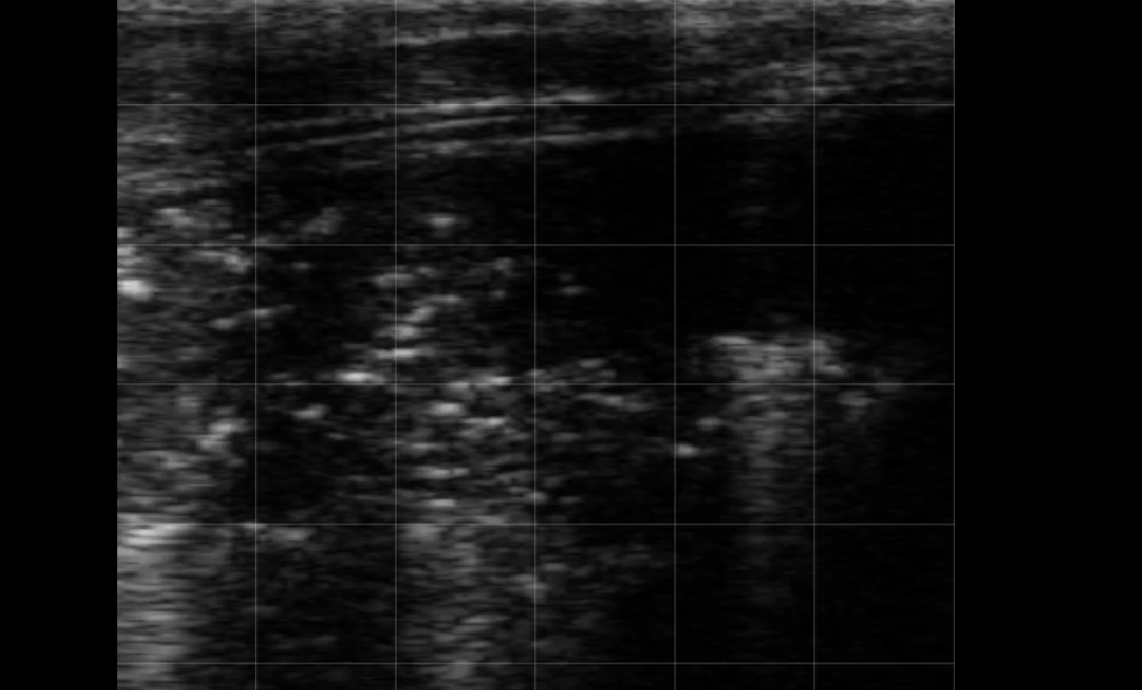 Calf Severe Lung Consolidation 7