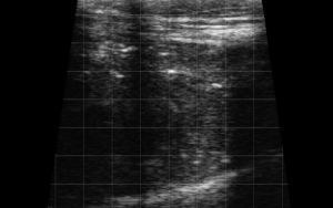 Calf Severe Lung Consolidation 8