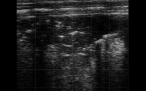 Calf Severe Lung Consolidation 9