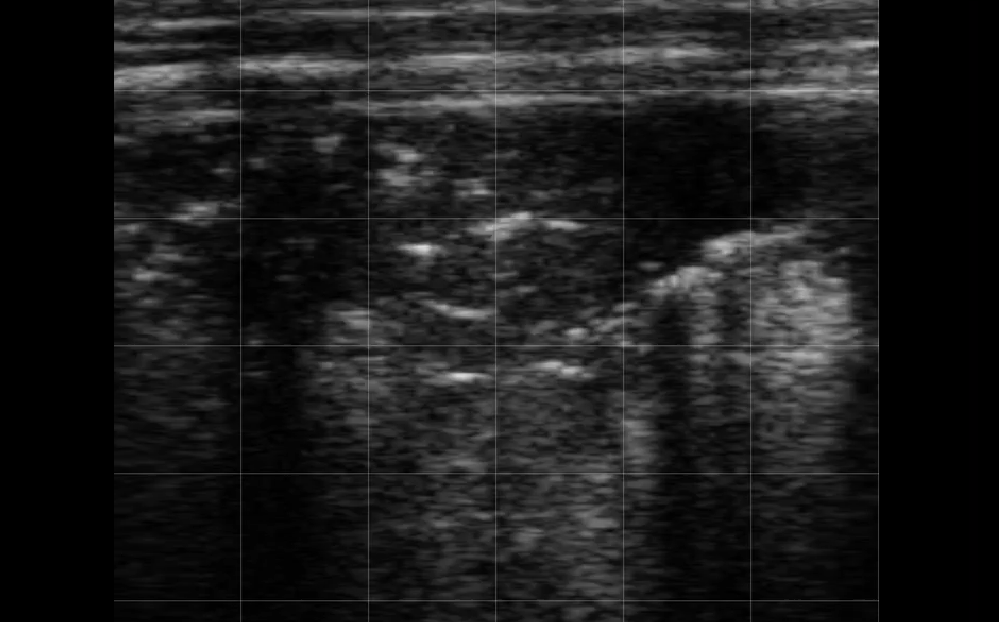 Calf Severe Lung Consolidation 9