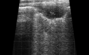 Calf Severe Lung Consolidation 10