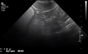 Canine Spleen Head (Transverse) - NORMAL