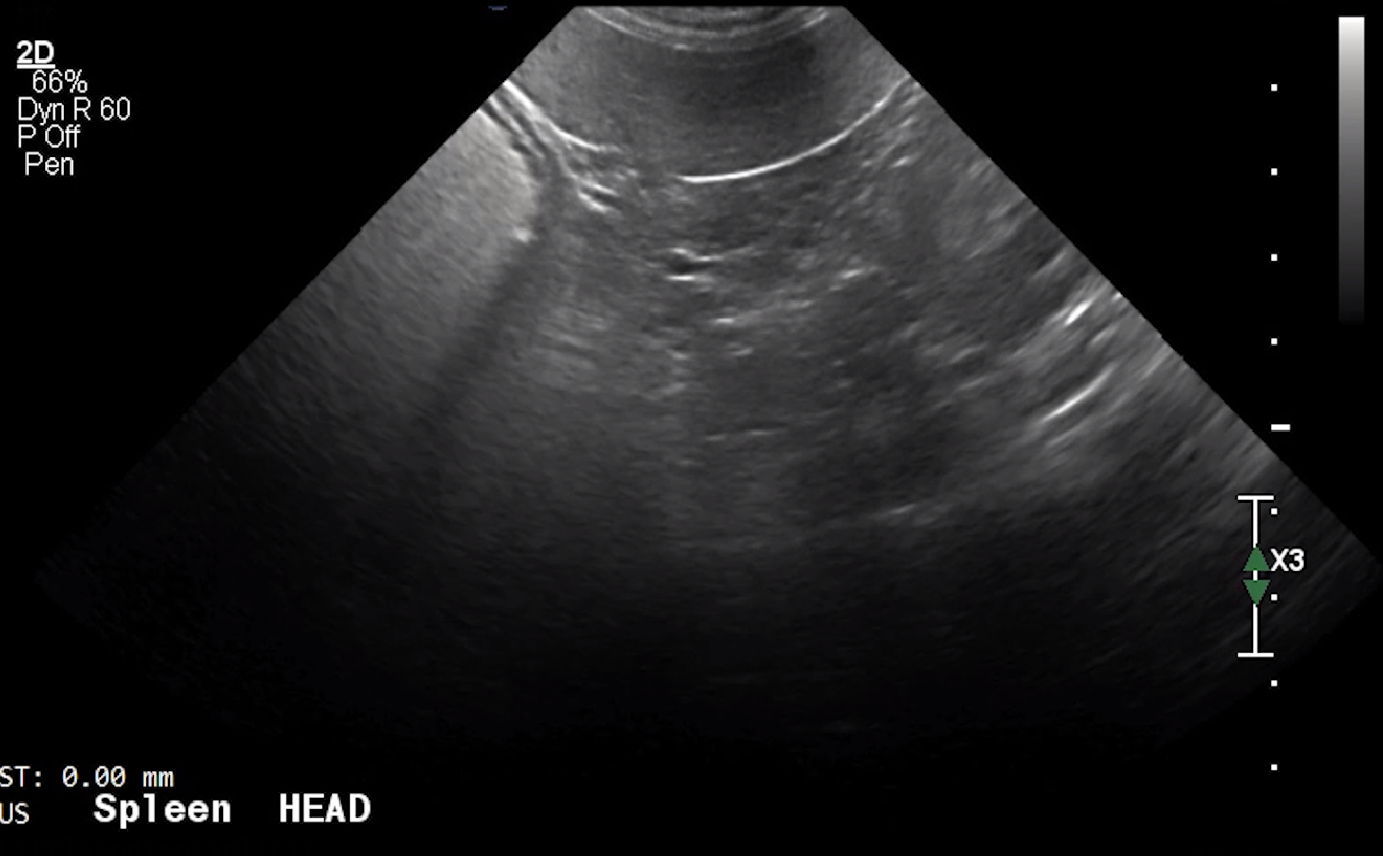 Canine Spleen Head (Transverse) – NORMAL