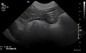 Canine Stomach (Transverse) - NORMAL