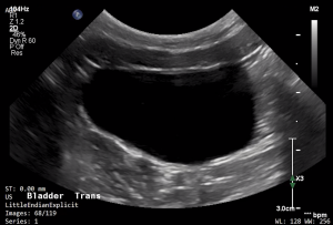 Feline Urinary Bladder (Transverse) - NORMAL