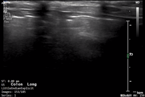 Feline Colon (Longitudinal) - NORMAL