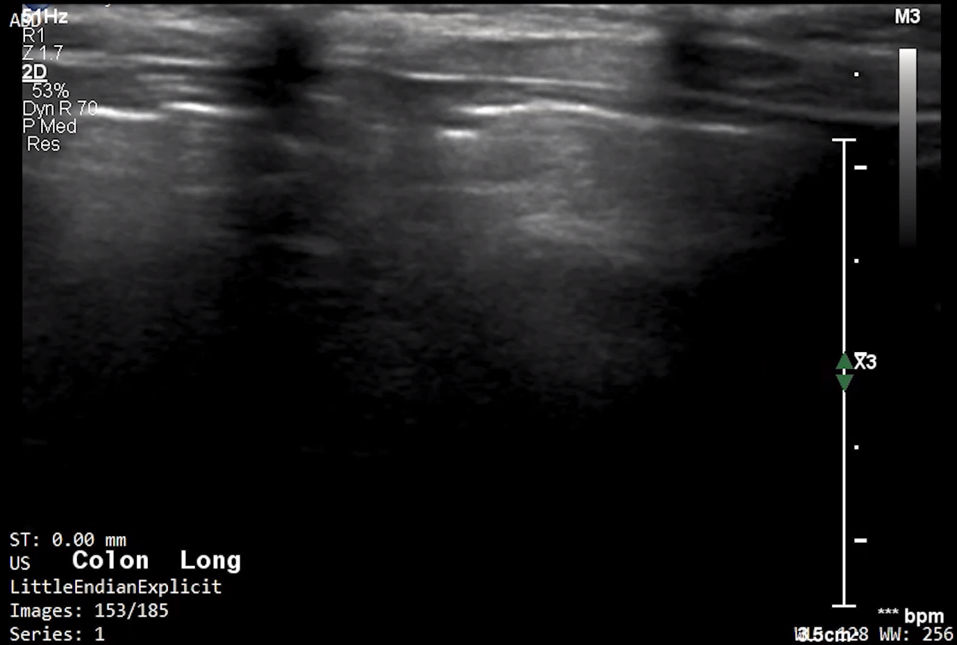 Feline Colon (Longitudinal) – NORMAL