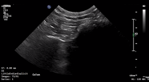 Feline Colon (Transverse) 1 - NORMAL