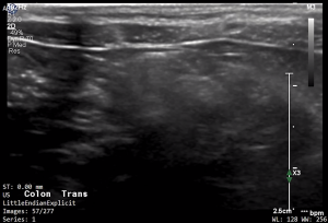 Feline Colon (Transverse) 2 - NORMAL