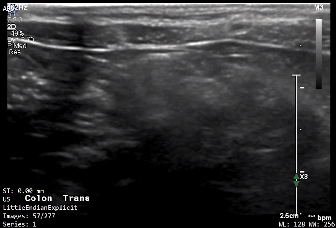 Feline Colon (Transverse) 2 – NORMAL
