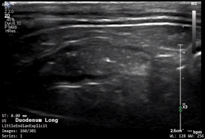 Feline Duodenum (Longitudinal) 1 - NORMAL