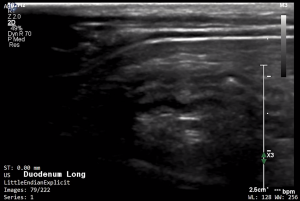 Feline Duodenum (Longitudinal) 2 - NORMAL