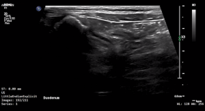 Feline Duodenum (Longitudinal) 3 - NORMAL