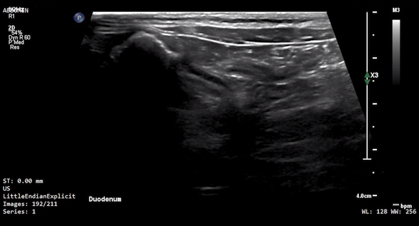 Feline Duodenum (Longitudinal) 3 – NORMAL