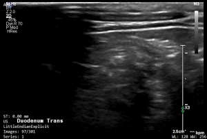 Feline Duodenum (Transverse) 1 - NORMAL