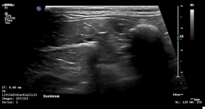 Feline Duodenum (Transverse) 2 - NORMAL