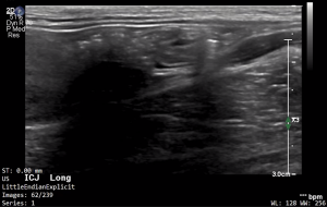 Feline ICJ (Longitudinal) - NORMAL