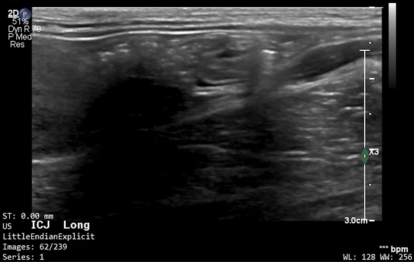 Feline ICJ (Longitudinal) – NORMAL