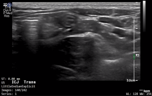 Feline ICJ (Transverse) - NORMAL