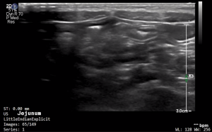 Feline Jejunum (Longitudinal) - NORMAL