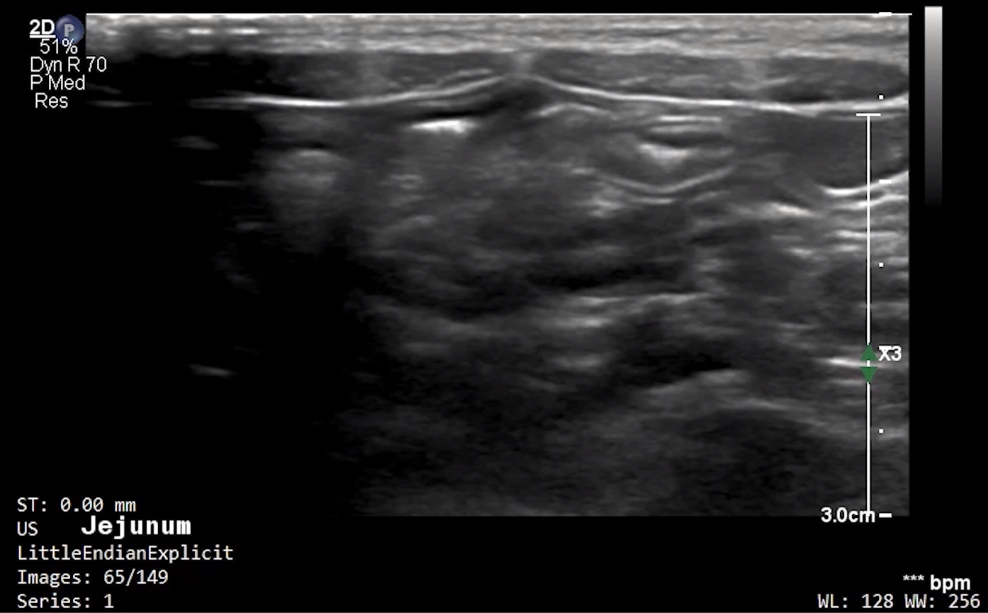 Feline Jejunum (Longitudinal) – NORMAL