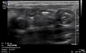 Feline Jejunum (Transverse) - NORMAL