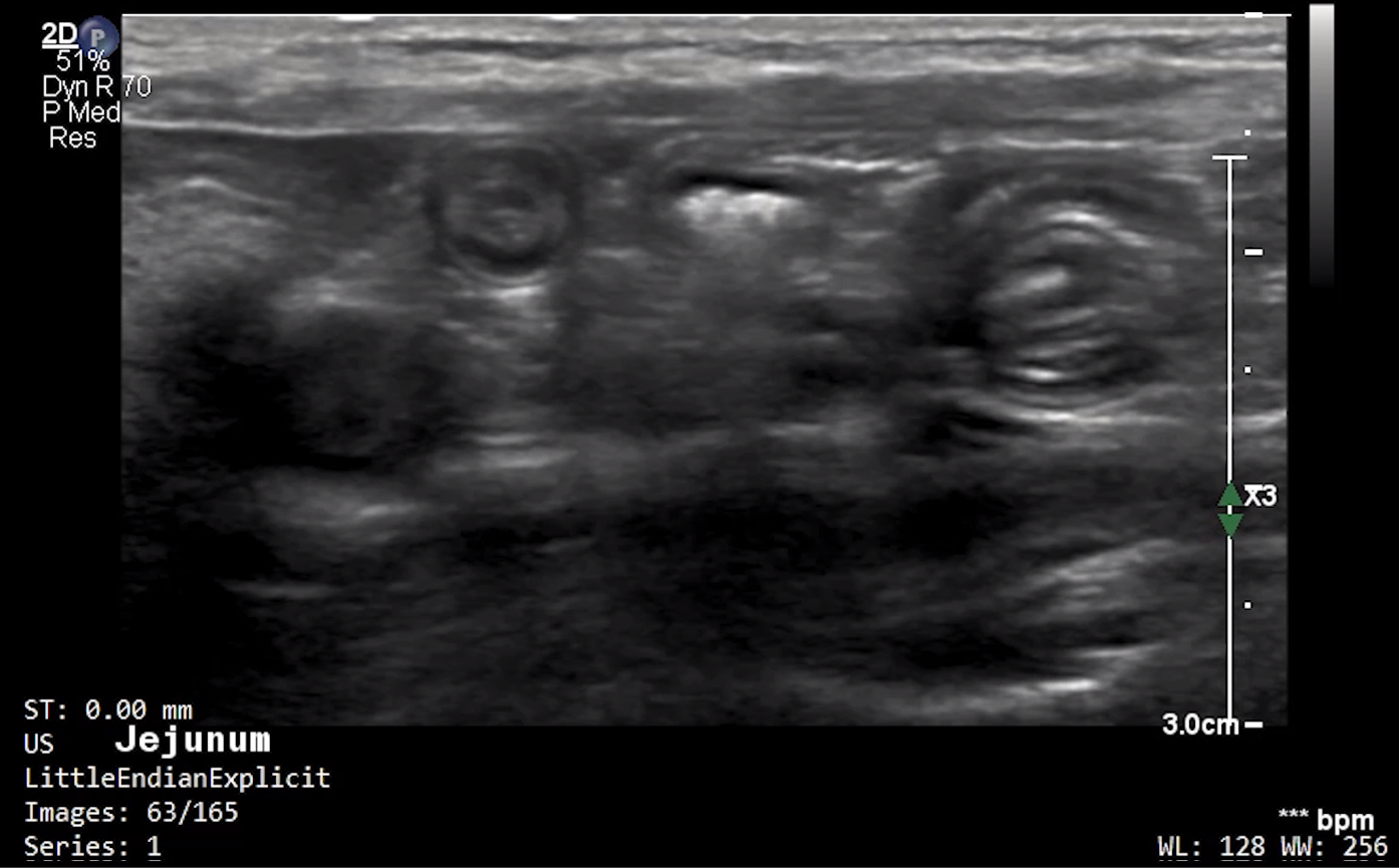 Feline Jejunum (Transverse) – NORMAL