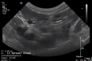 Feline Left Adrenal Gland (Longitudinal) - NORMAL
