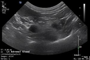 Feline Left Adrenal Gland (Transverse) - NORMAL