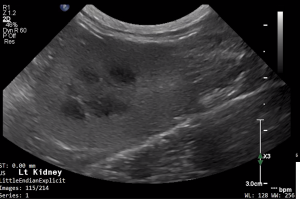 Feline Left Kidney (Longitudinal) 2 - NORMAL