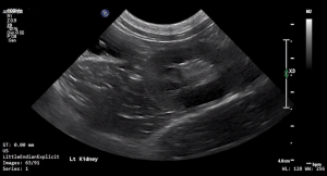 Feline Left Kidney (Longitudinal) 1 - NORMAL