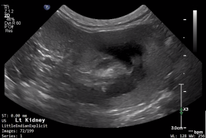 Feline Left Kidney (Transverse) 1 - NORMAL
