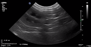 Feline Left Kidney (Transverse) 2 - NORMAL