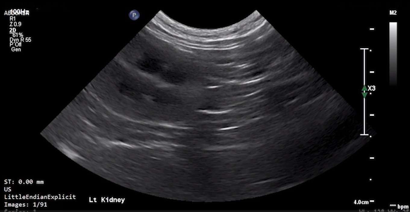 Feline Left Kidney (Transverse) 2 – NORMAL