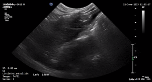 Feline Left Liver - NORMAL