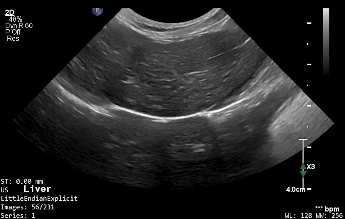 Feline Liver 1 – NORMAL