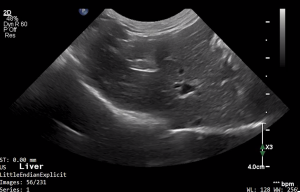 Feline Liver 2 - NORMAL
