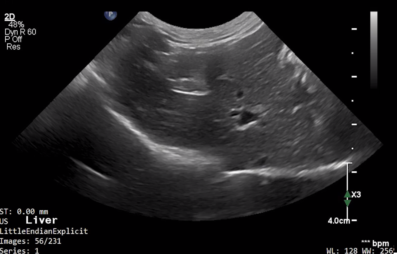 Feline Liver 2 – NORMAL