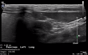 Feline Left Pancreas (Longitudinal) - NORMAL