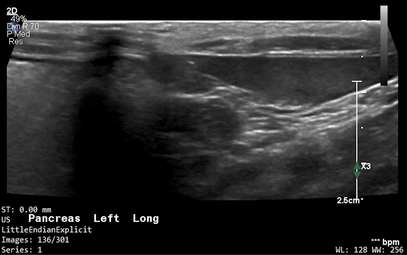 Feline Left Pancreas (Longitudinal) – NORMAL