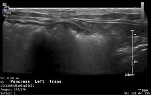 Feline Left Pancreas (Transverse) - NORMAL