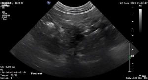 Feline Pancreas - NORMAL